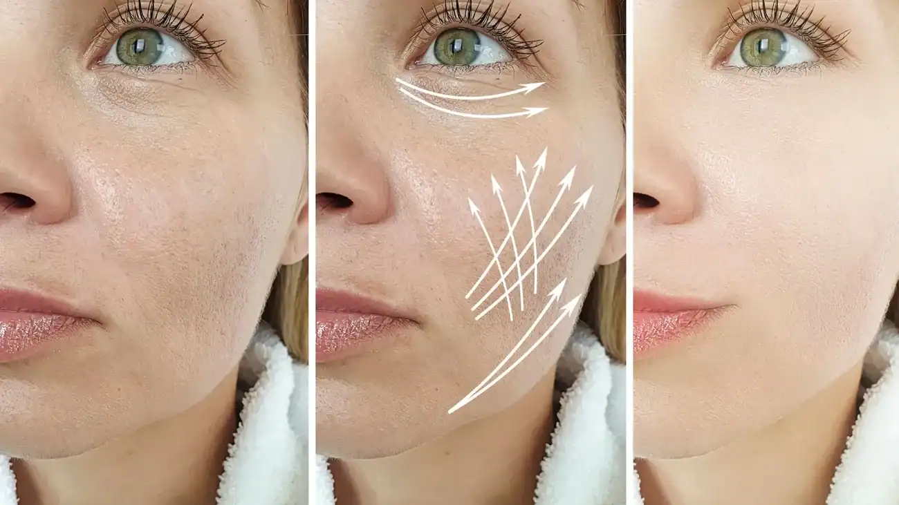 Can One Treatment Really Tackle More Than One Skin Concern Windsor?