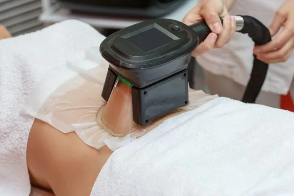 Image of person having fat freezing treatment to help weight gain Windsor