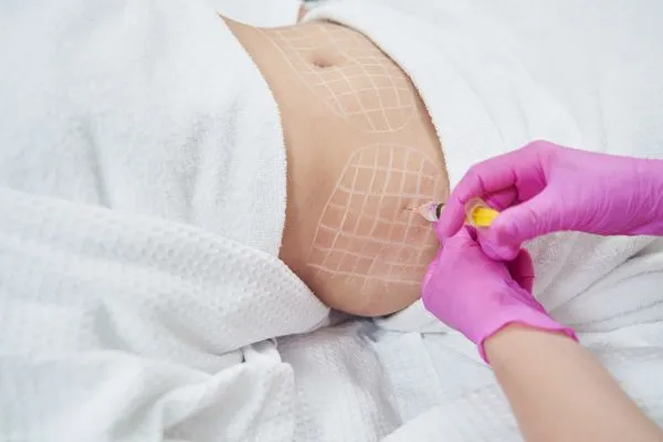 image of fat dissolving injections on love handles to help combat weight gain Windsor