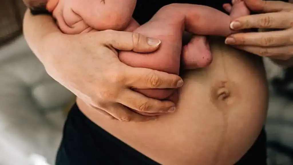 Why Is My Stomach Still Big After Pregnancy Windsor?